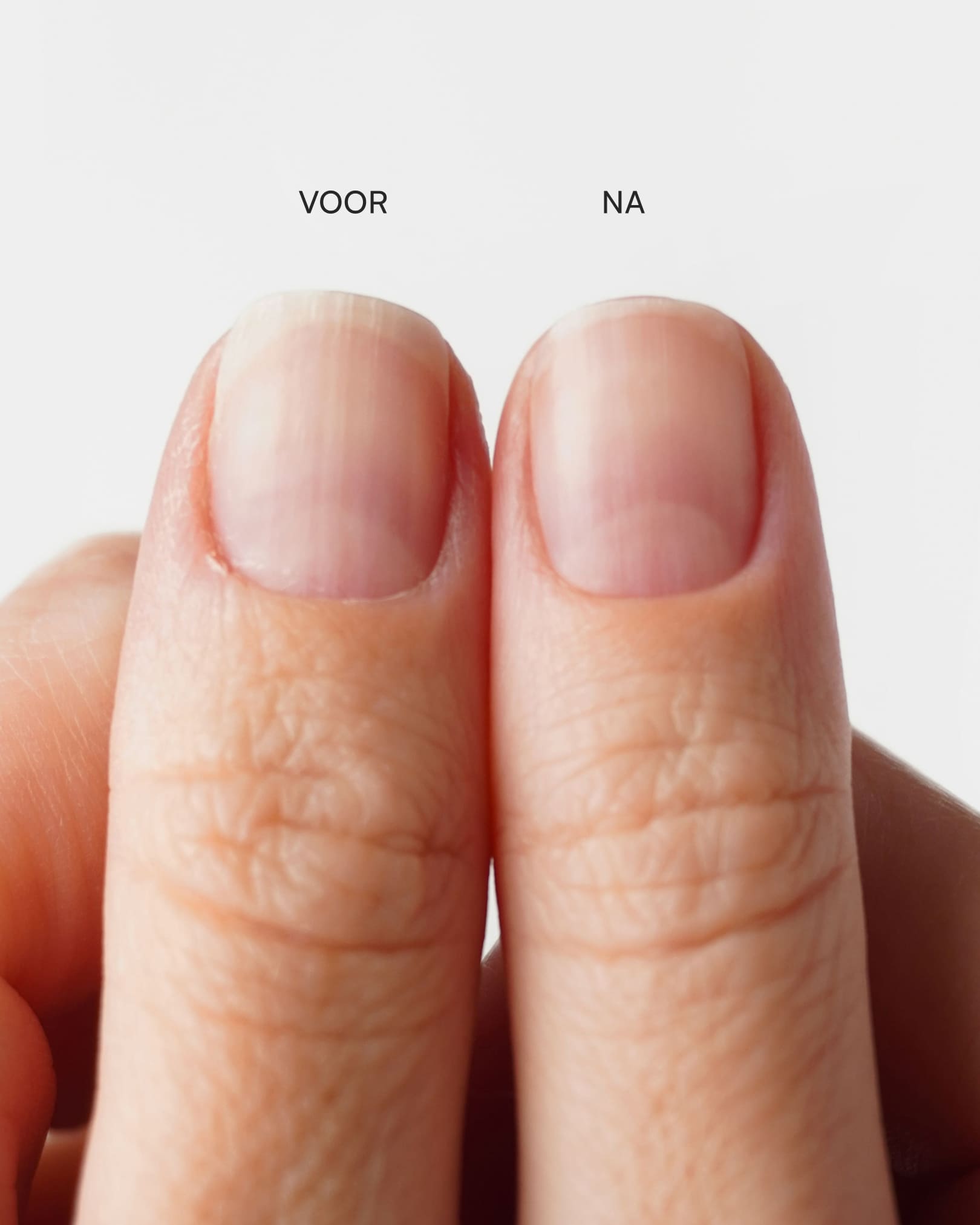 Nagelriemtang