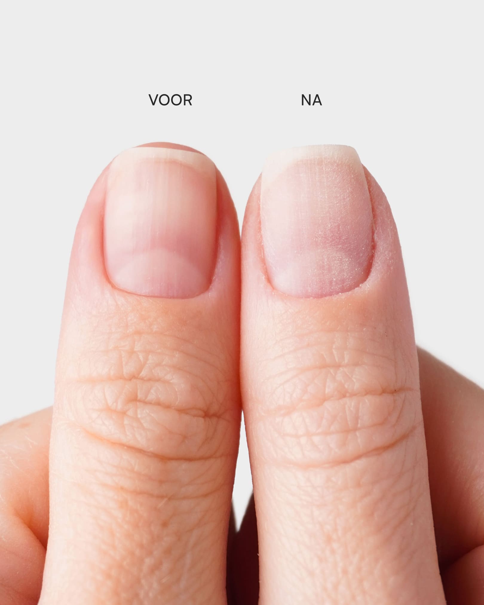 Premium Buffervijlen Set